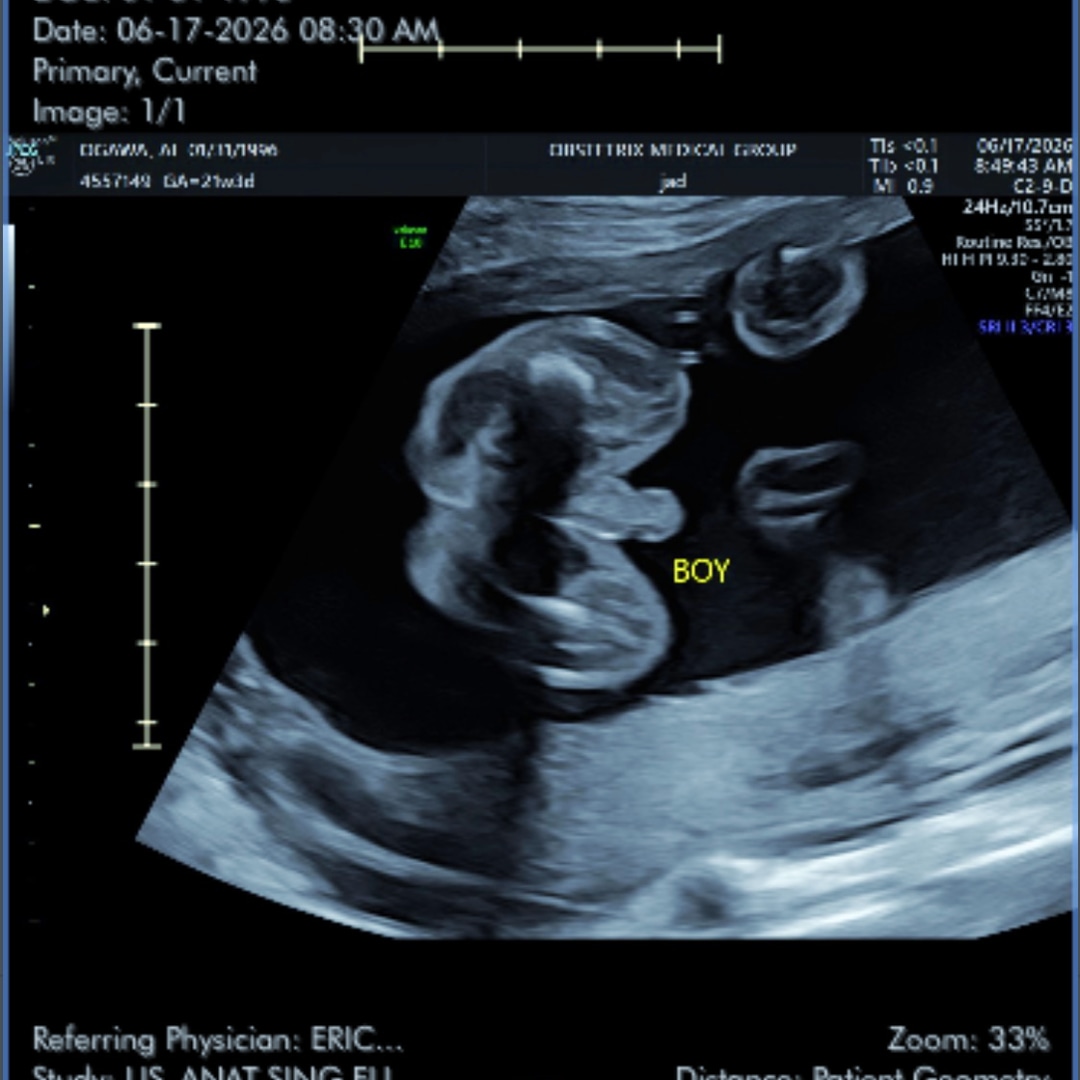 Photo shared by Ai for their Babylist baby registry.