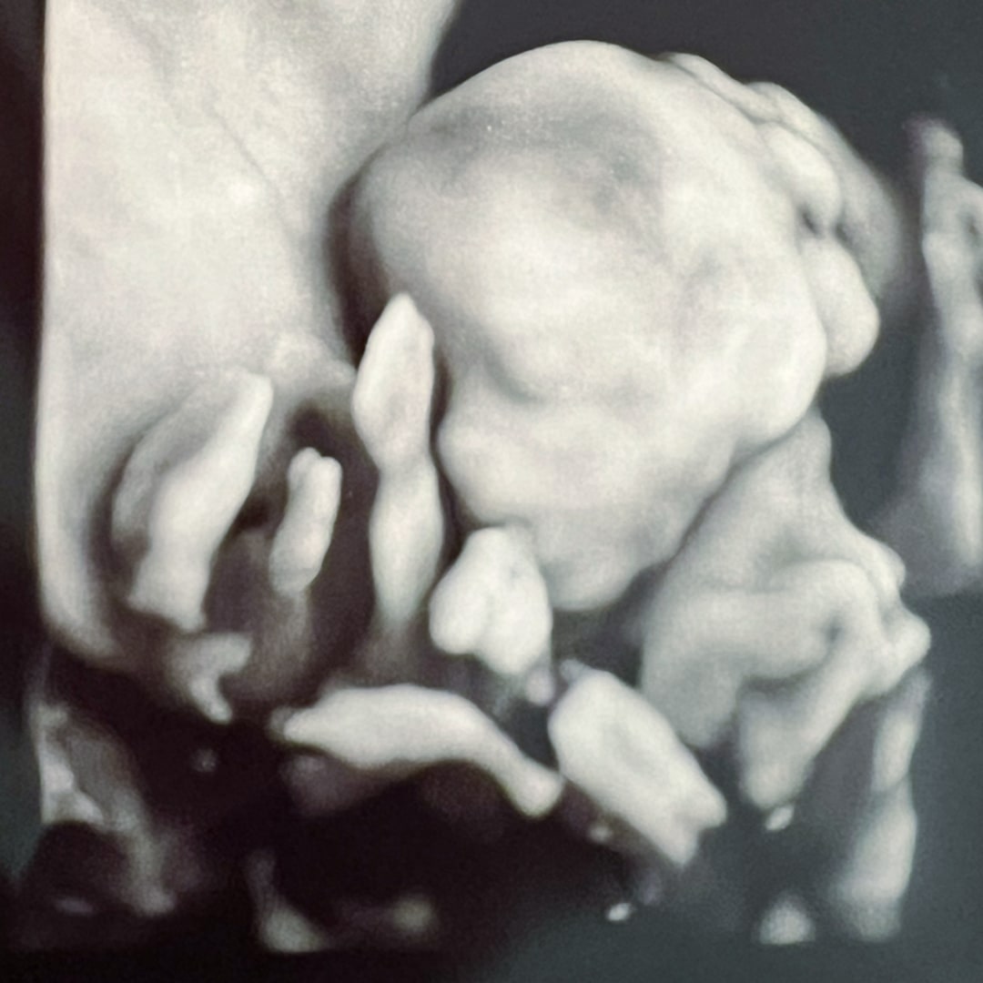 Photo shared by Amanda for their Babylist baby registry.