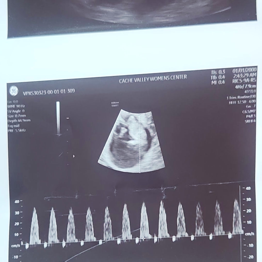 Photo shared by Kaylie for their Babylist baby registry.