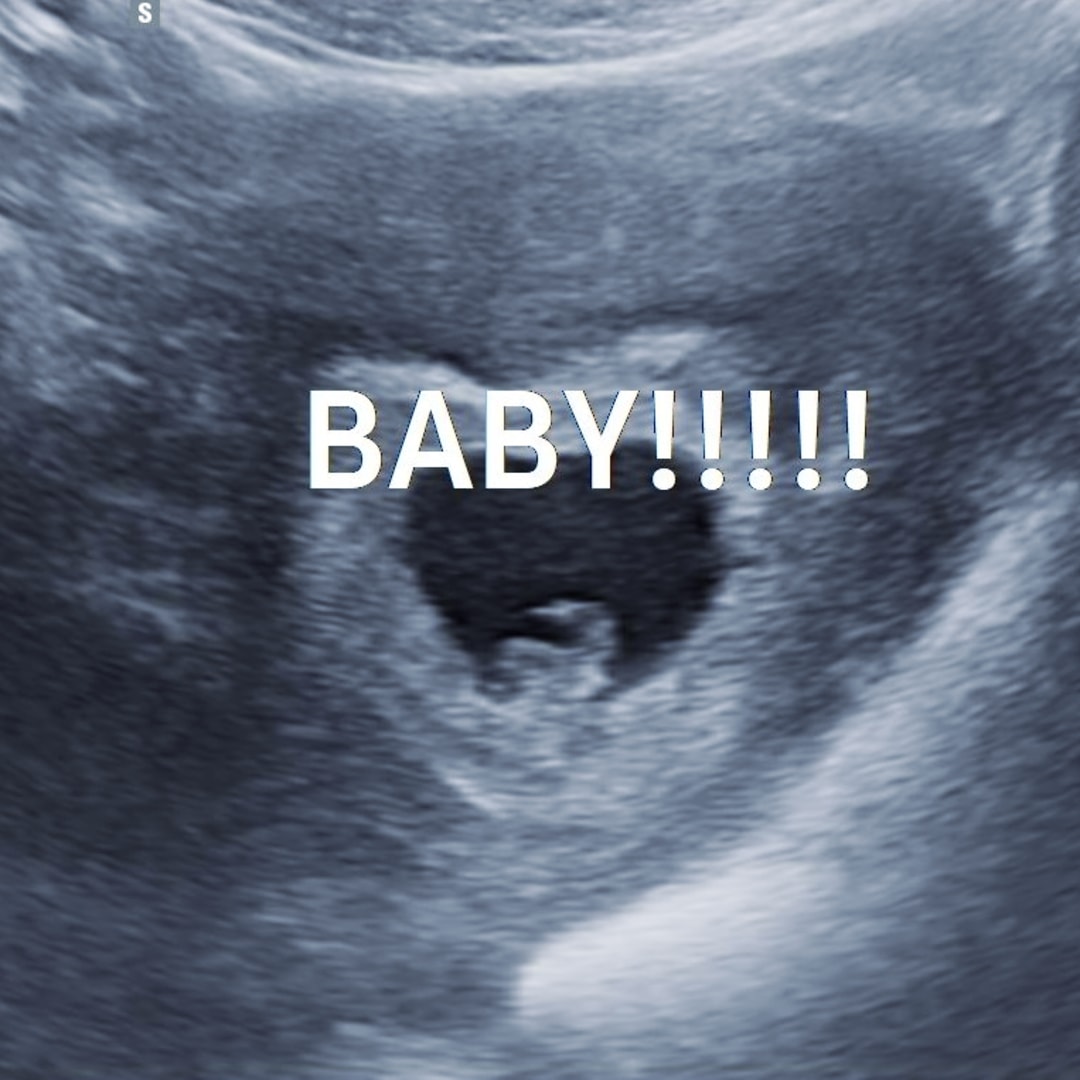 Photo shared by Wyllow for their Babylist baby registry.