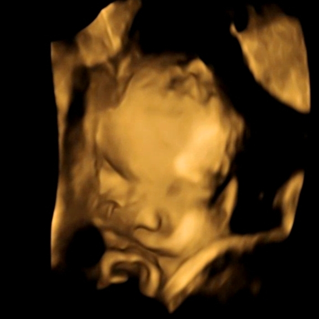 Photo shared by Julia for their Babylist baby registry.