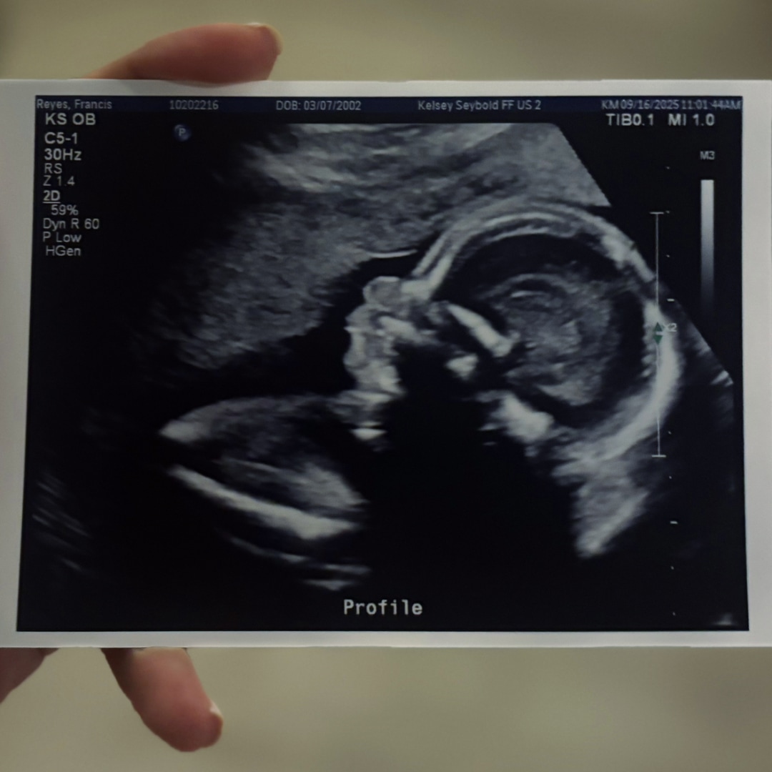 Photo shared by Francis for their Babylist baby registry.
