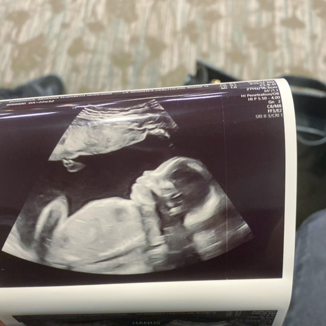 Photo shared by Brianna for their Babylist baby registry.
