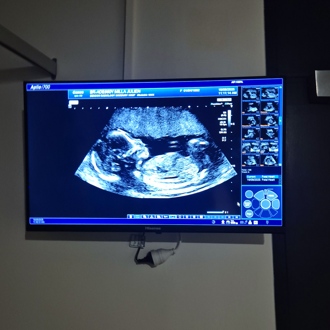 Photo shared by Julien April for their Babylist baby registry.