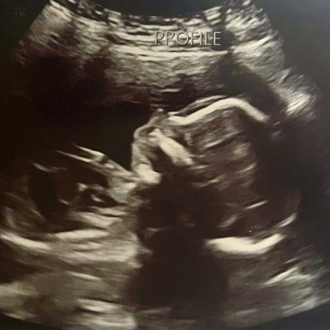 Photo shared by Nikki for their Babylist baby registry.