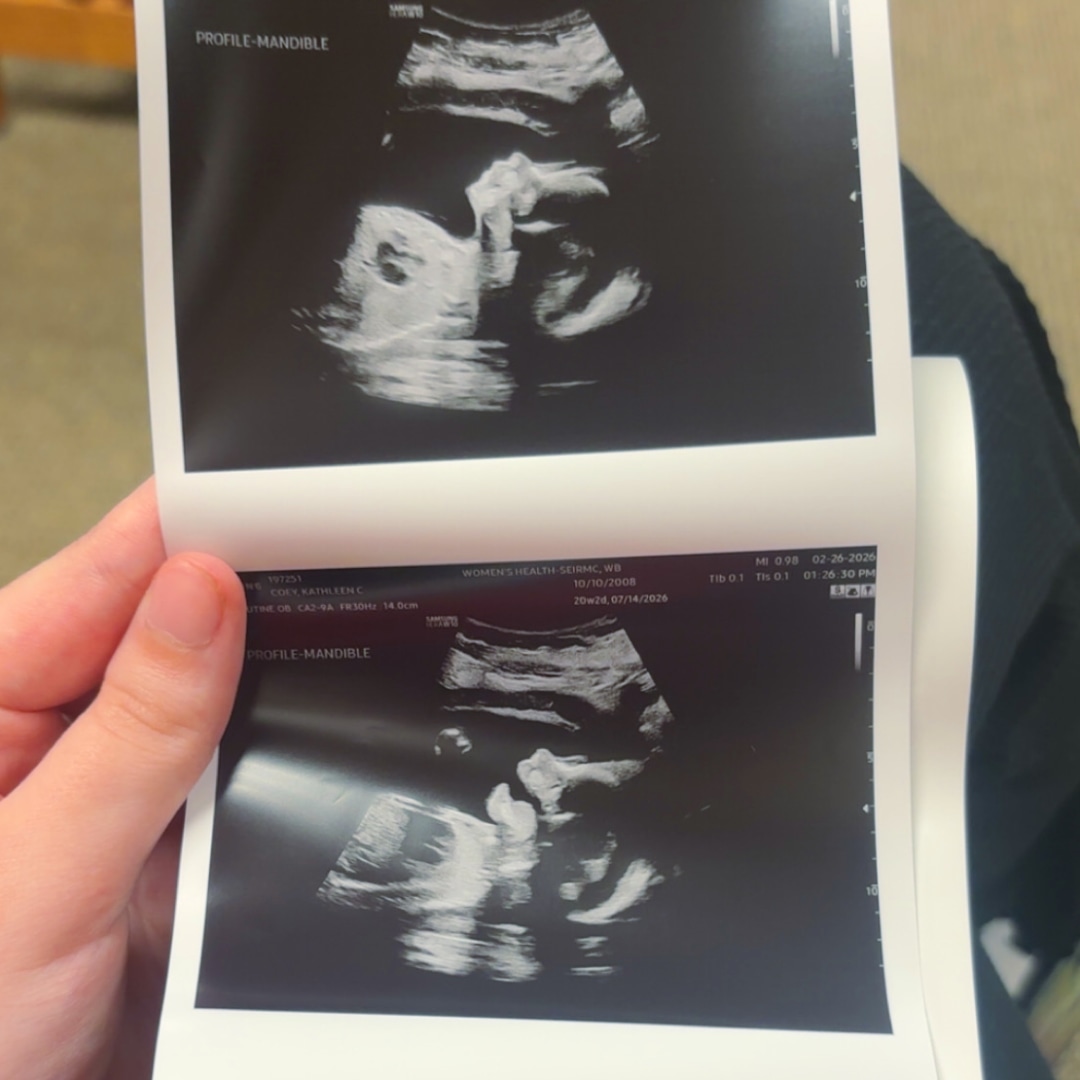 Photo shared by Kathleen for their Babylist baby registry.