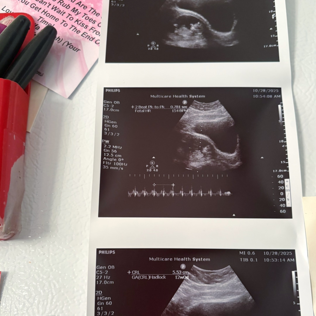 Photo shared by Lydia for their Babylist baby registry.