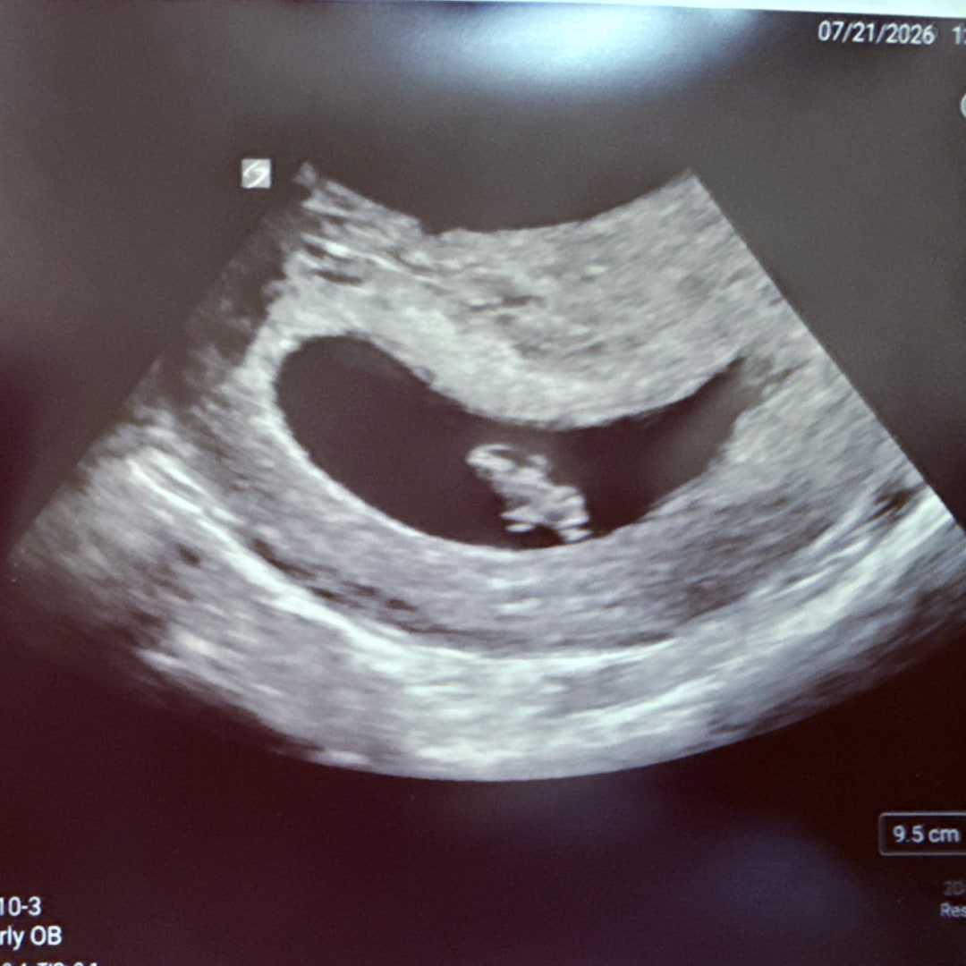 Photo shared by Kathryn for their Babylist baby registry.