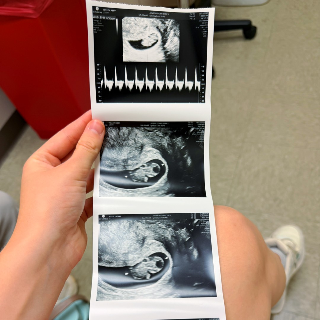 Photo shared by Abby for their Babylist baby registry.