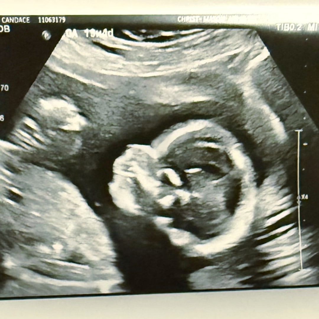 Photo shared by Candace for their Babylist baby registry.