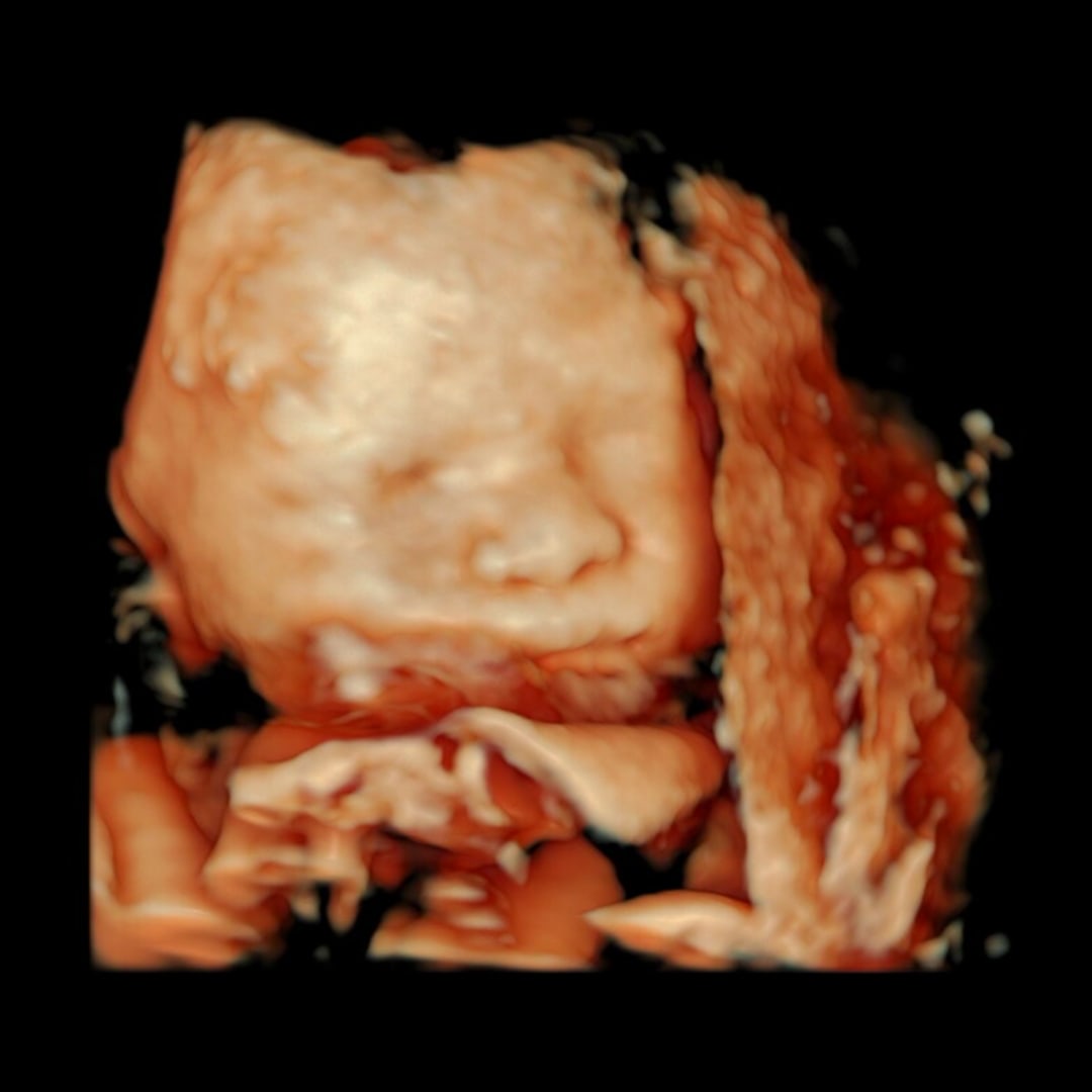 Photo shared by DANIEL JOERIZ for their Babylist baby registry.