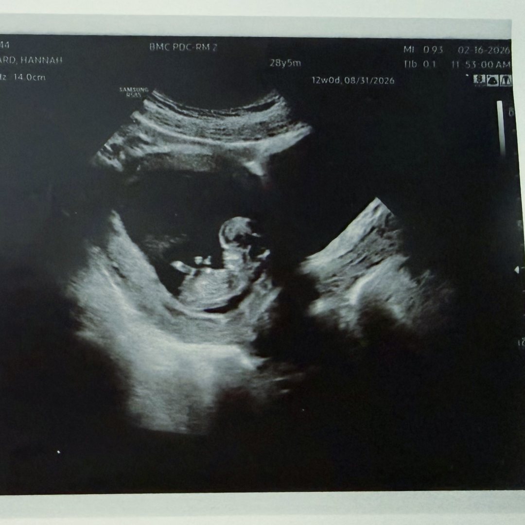 Photo shared by Hannah for their Babylist baby registry.