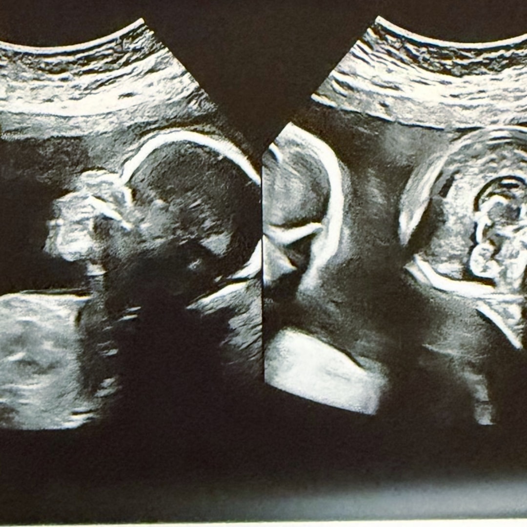 Photo shared by Maria for their Babylist baby registry.