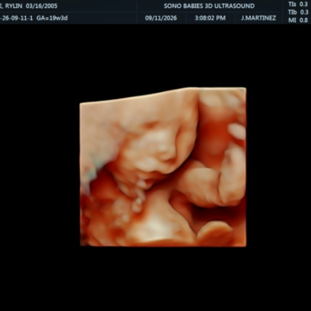 Photo shared by Rylin for their Babylist baby registry.