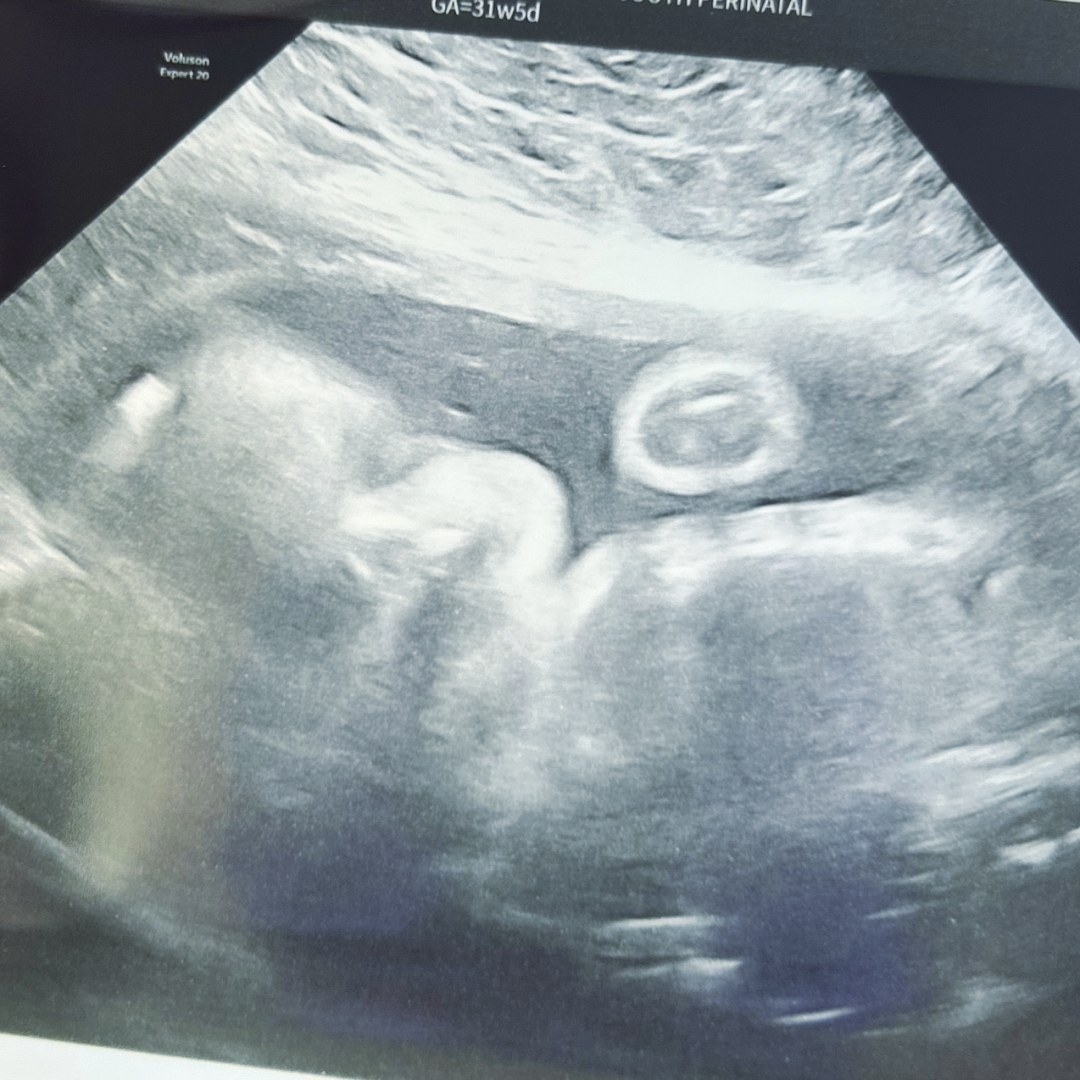 Photo shared by Lanna for their Babylist baby registry.
