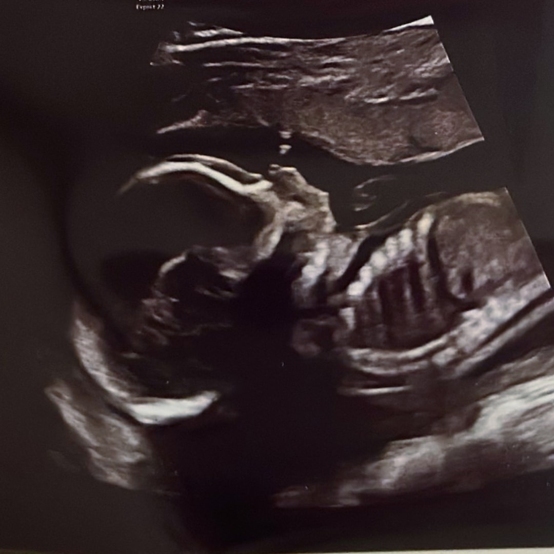 Photo shared by Alina for their Babylist baby registry.