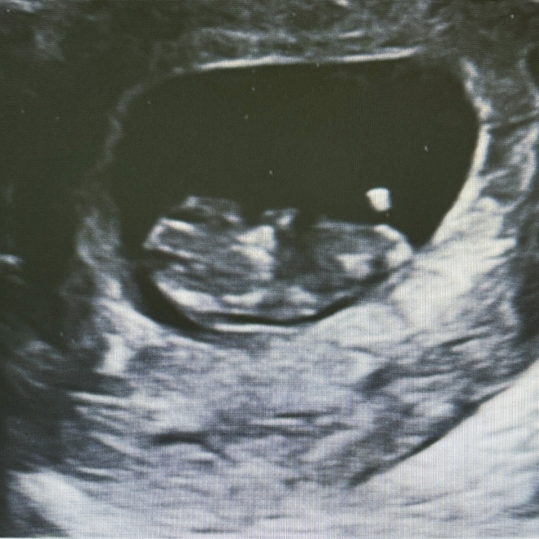 Photo shared by Giselle for their Babylist baby registry.