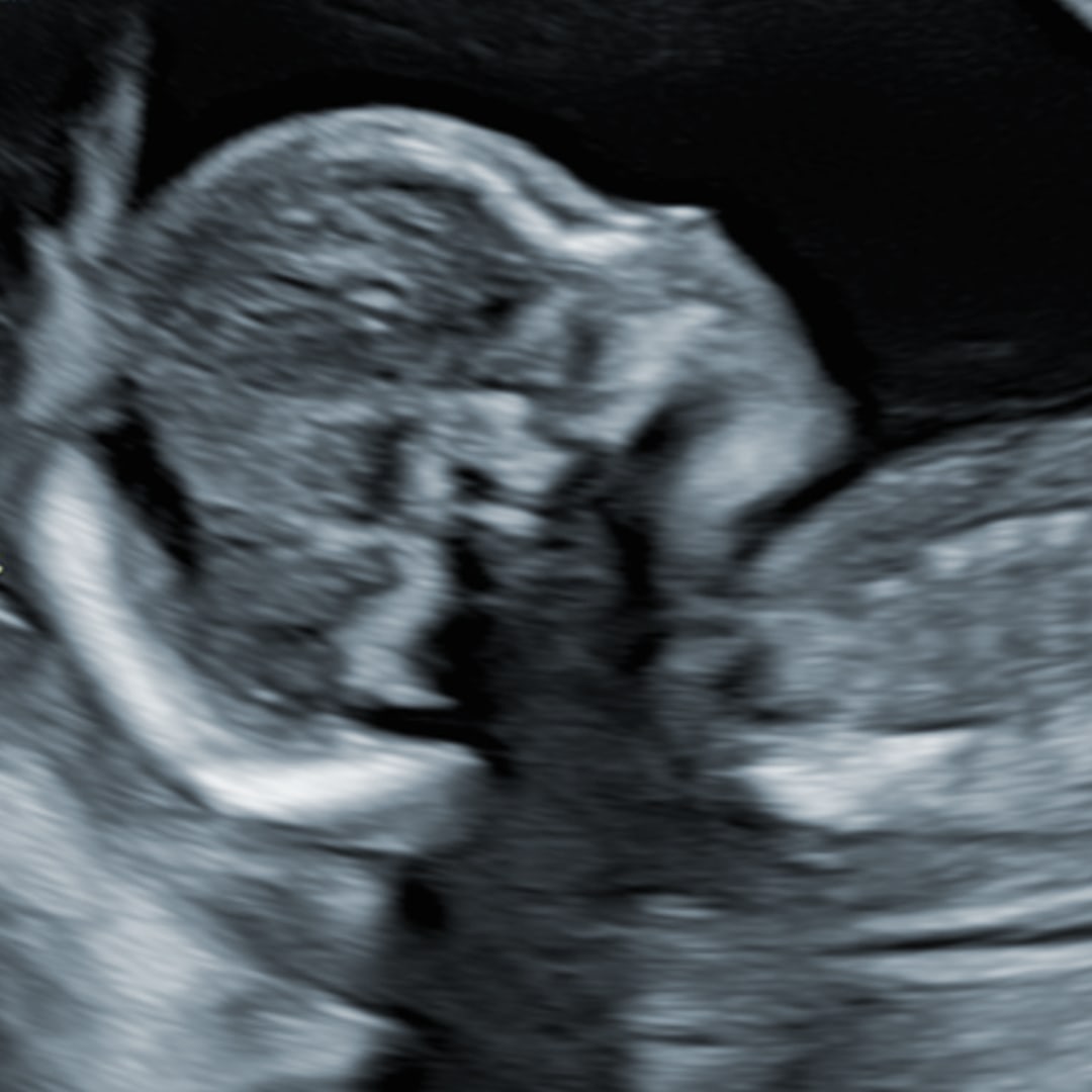 Photo shared by Alondra for their Babylist baby registry.