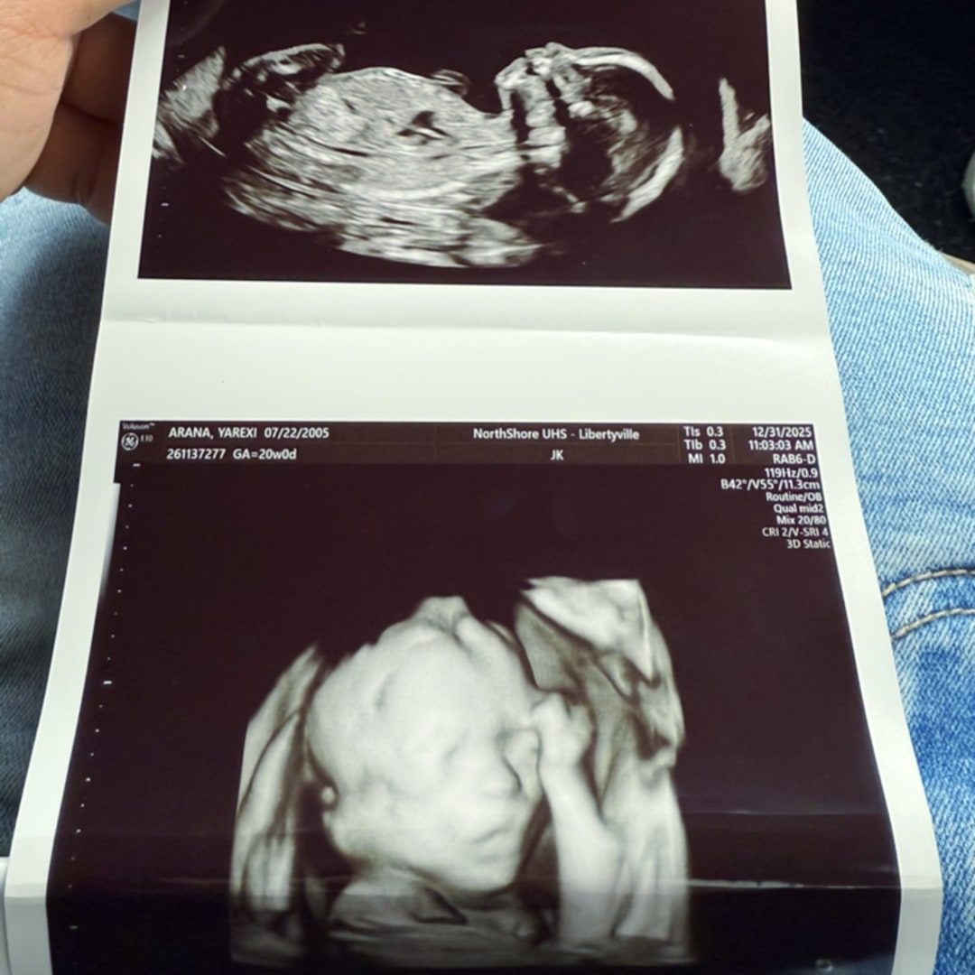Photo shared by Yarexi for their Babylist baby registry.