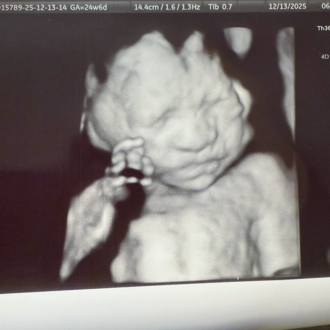 Photo shared by Mary for their Babylist baby registry.