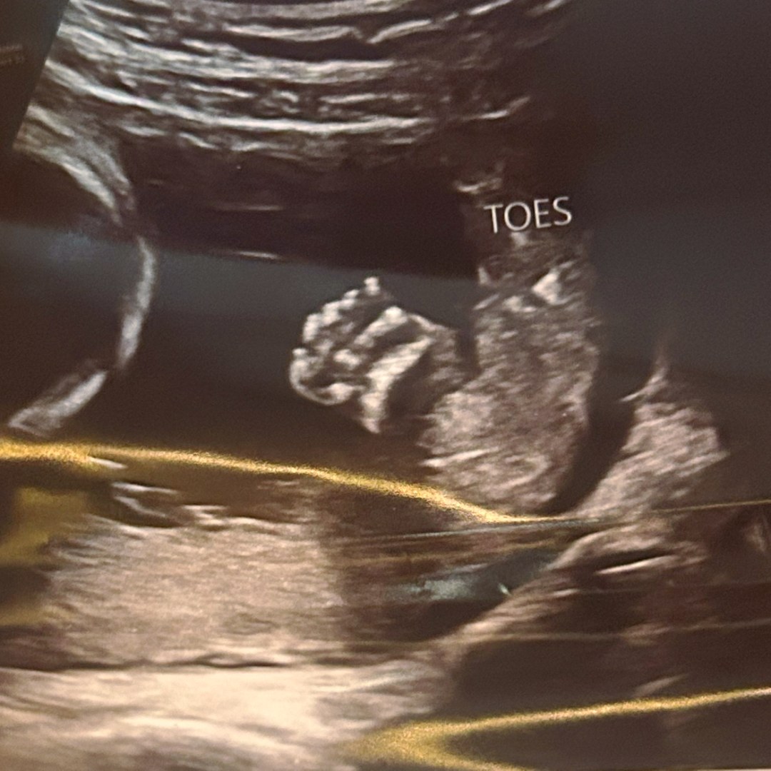 Photo shared by Haileigh for their Babylist baby registry.