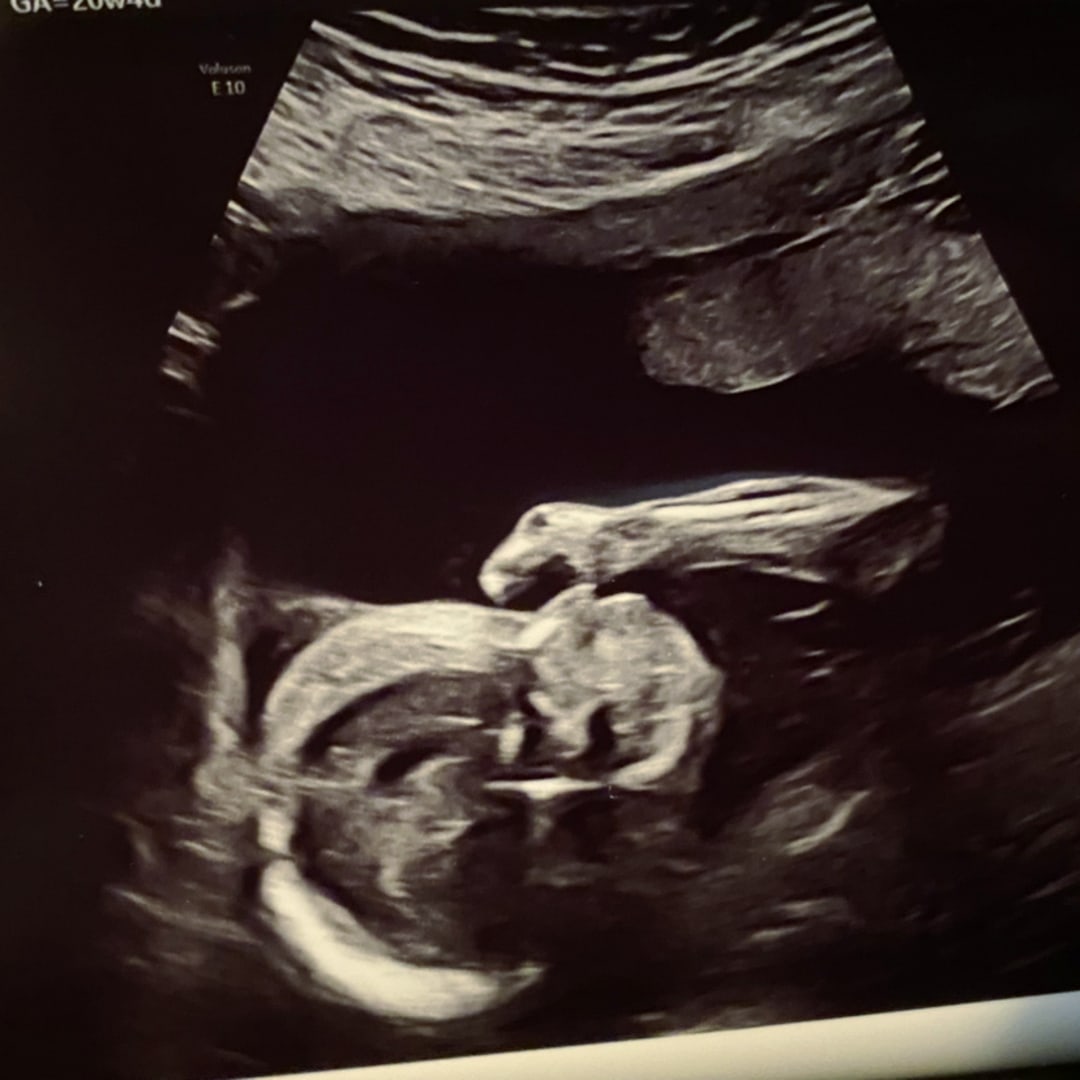 Photo shared by Destiney for their Babylist baby registry.