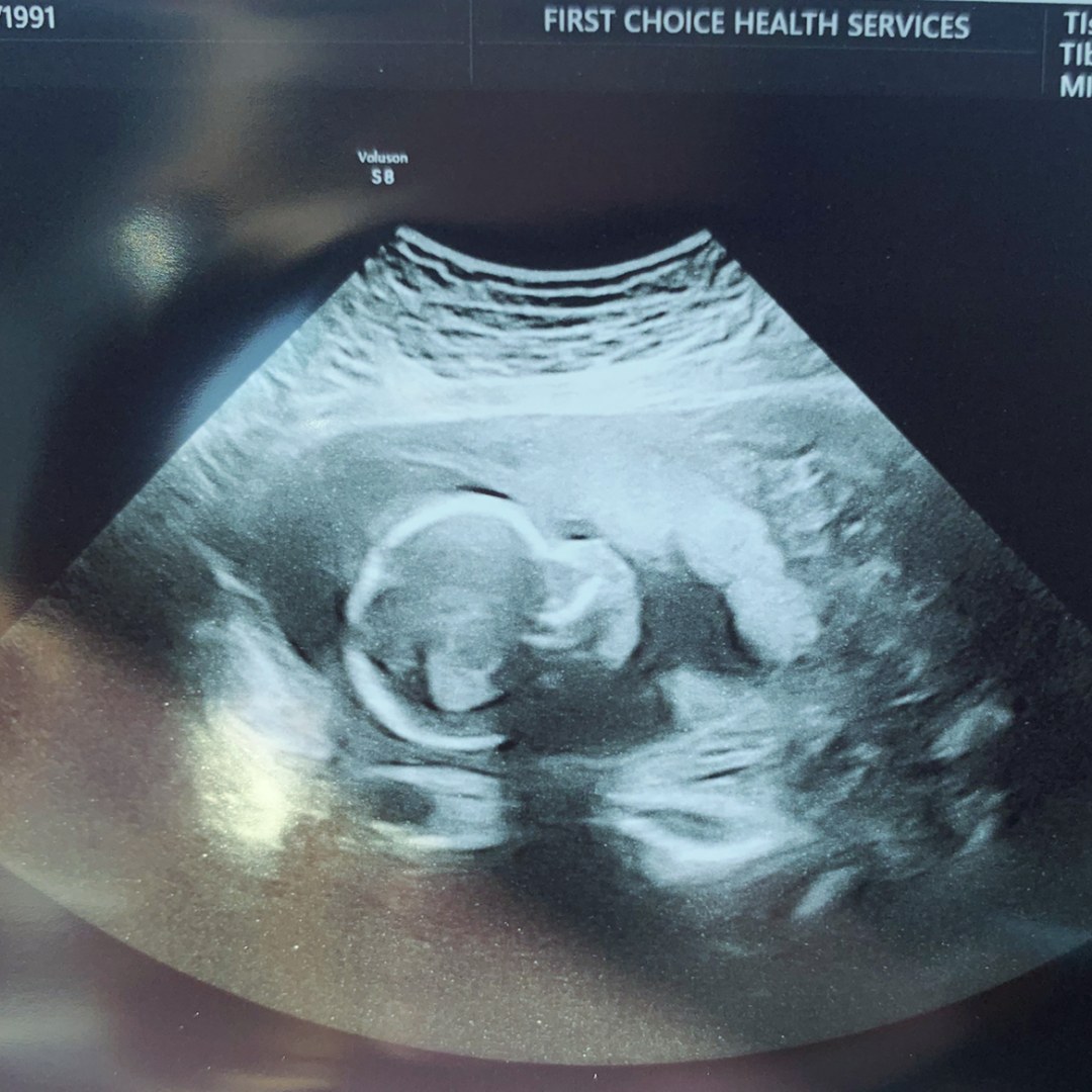 Photo shared by Jessica for their Babylist baby registry.