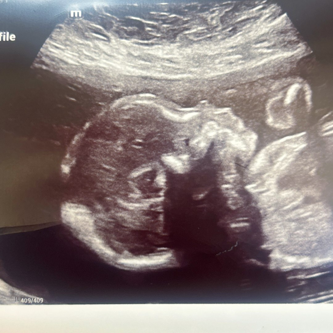 Photo shared by Makaylah for their Babylist baby registry.