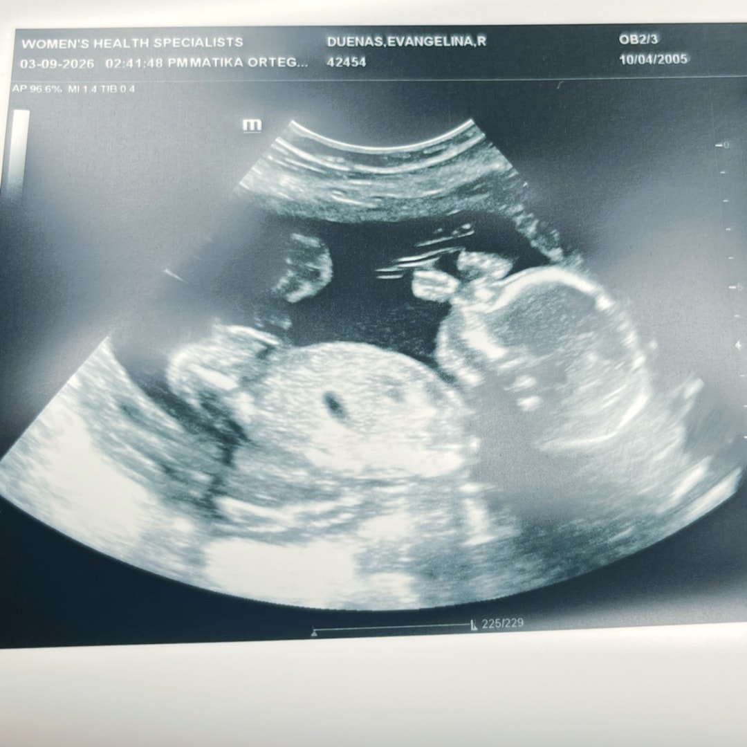 Photo shared by Lina for their Babylist baby registry.