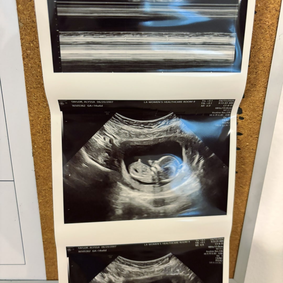 Photo shared by Alyssa for their Babylist baby registry.