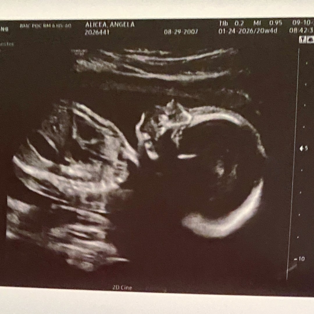 Photo shared by Angela and for their Babylist baby registry.