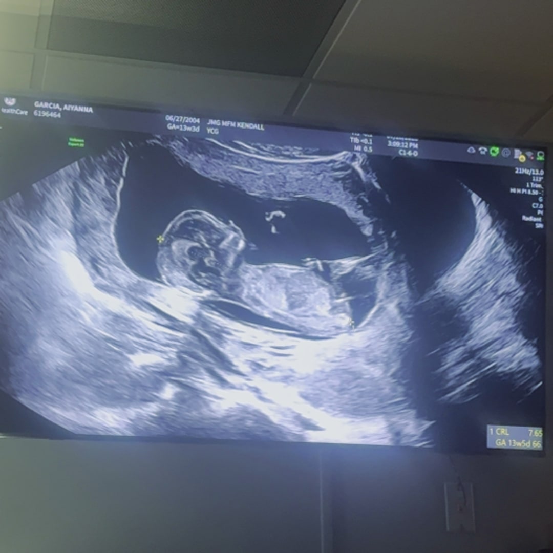 Photo shared by Aiyanna for their Babylist baby registry.