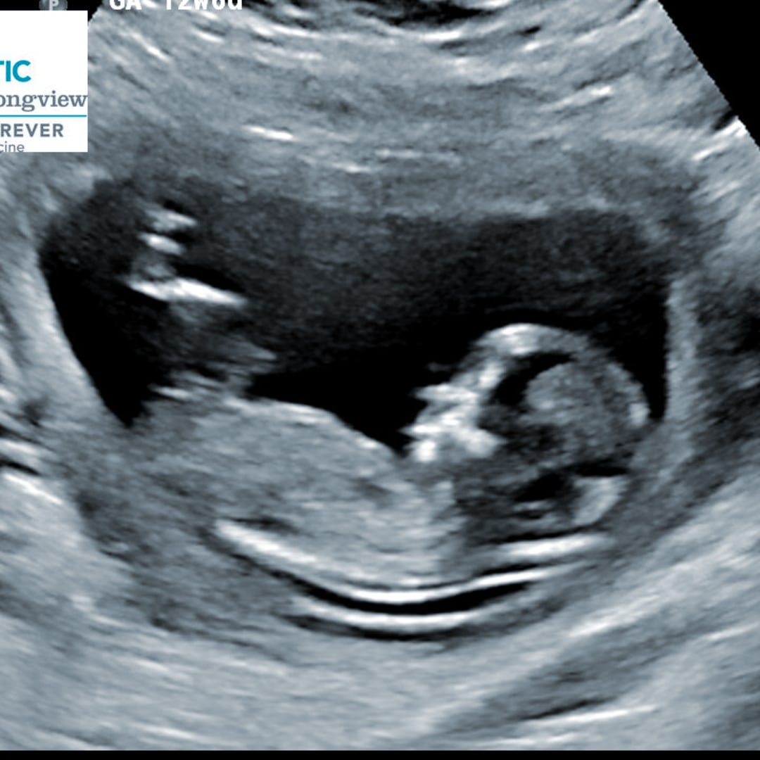 Photo shared by Cali for their Babylist baby registry.