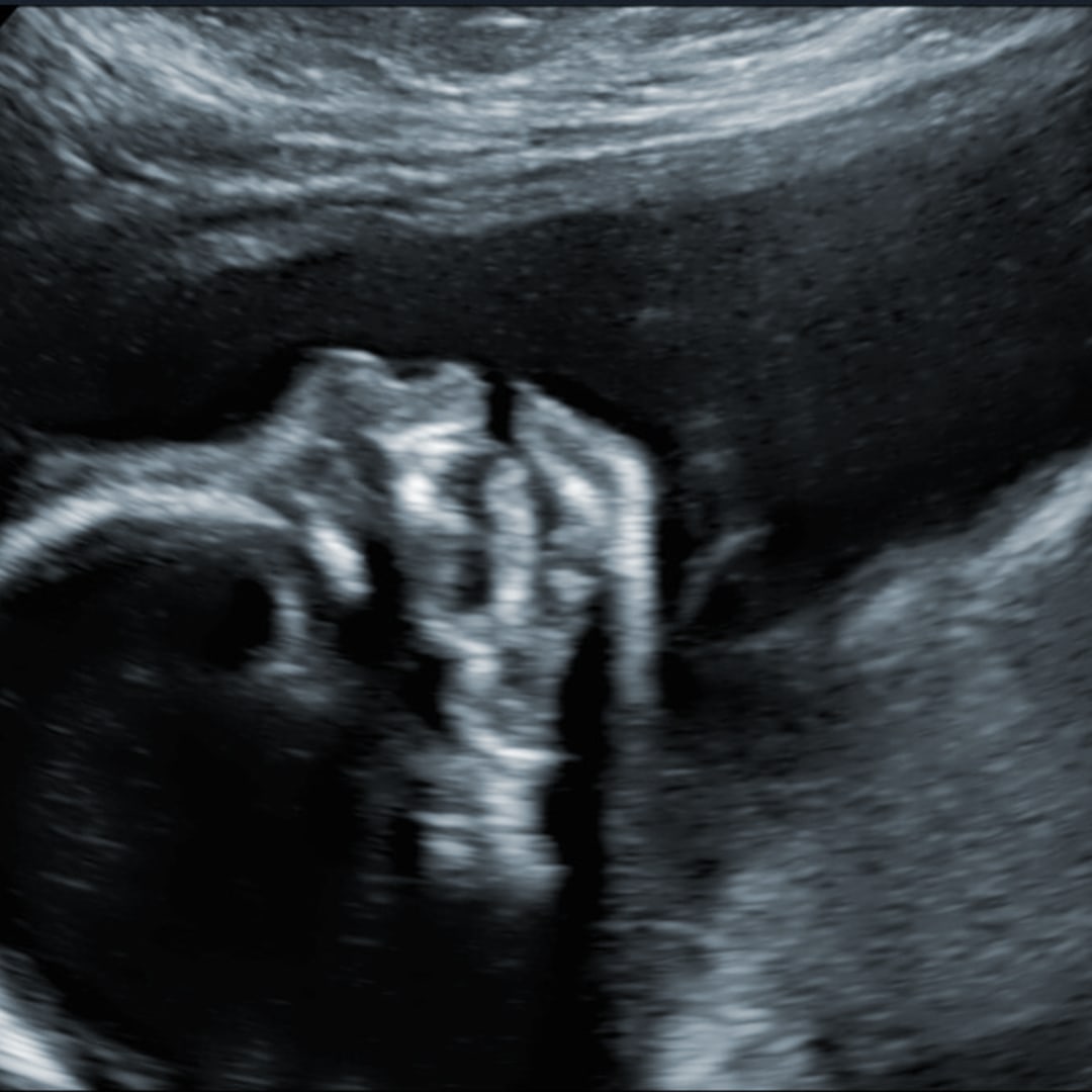 Photo shared by Nora for their Babylist baby registry.