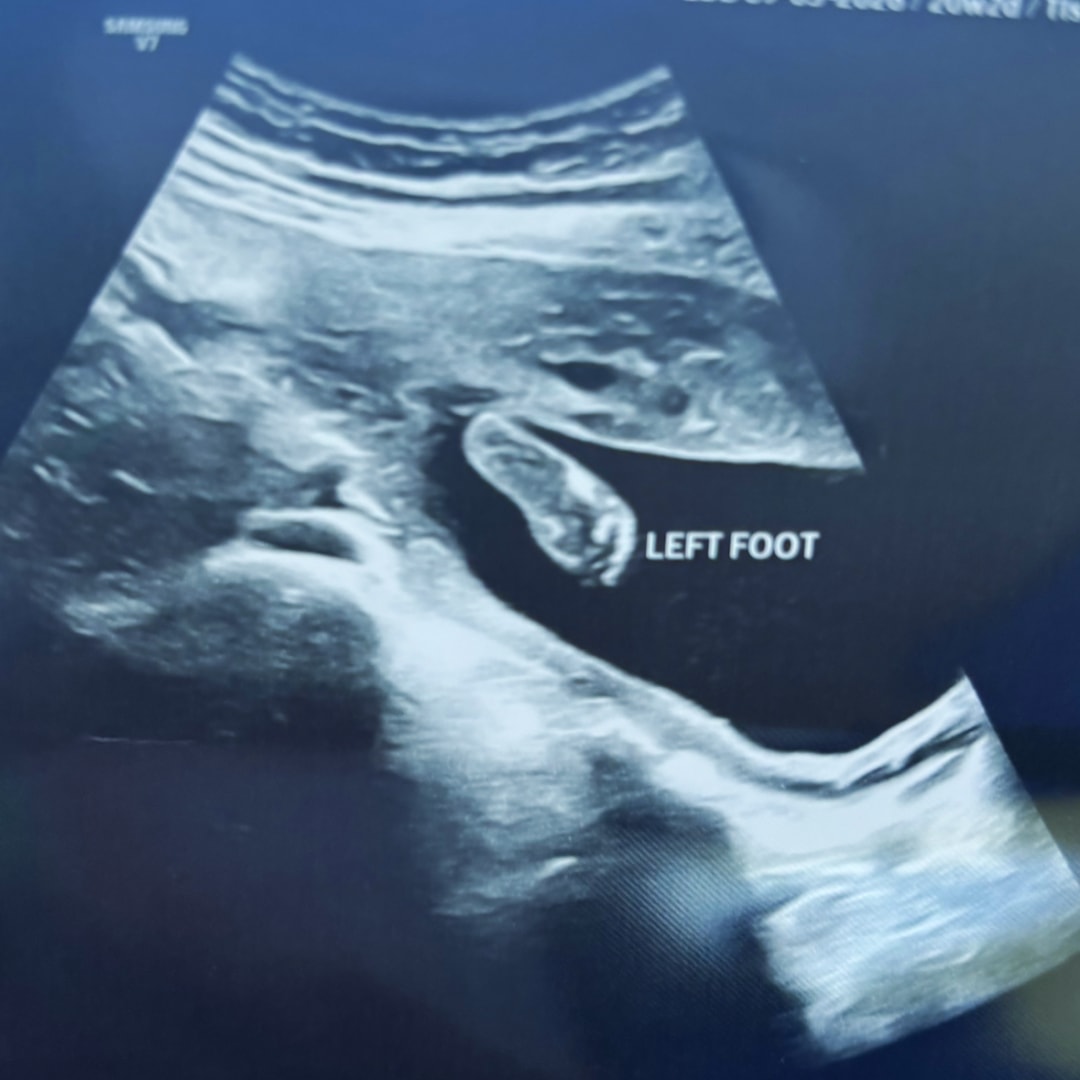 Photo shared by Allison for their Babylist baby registry.