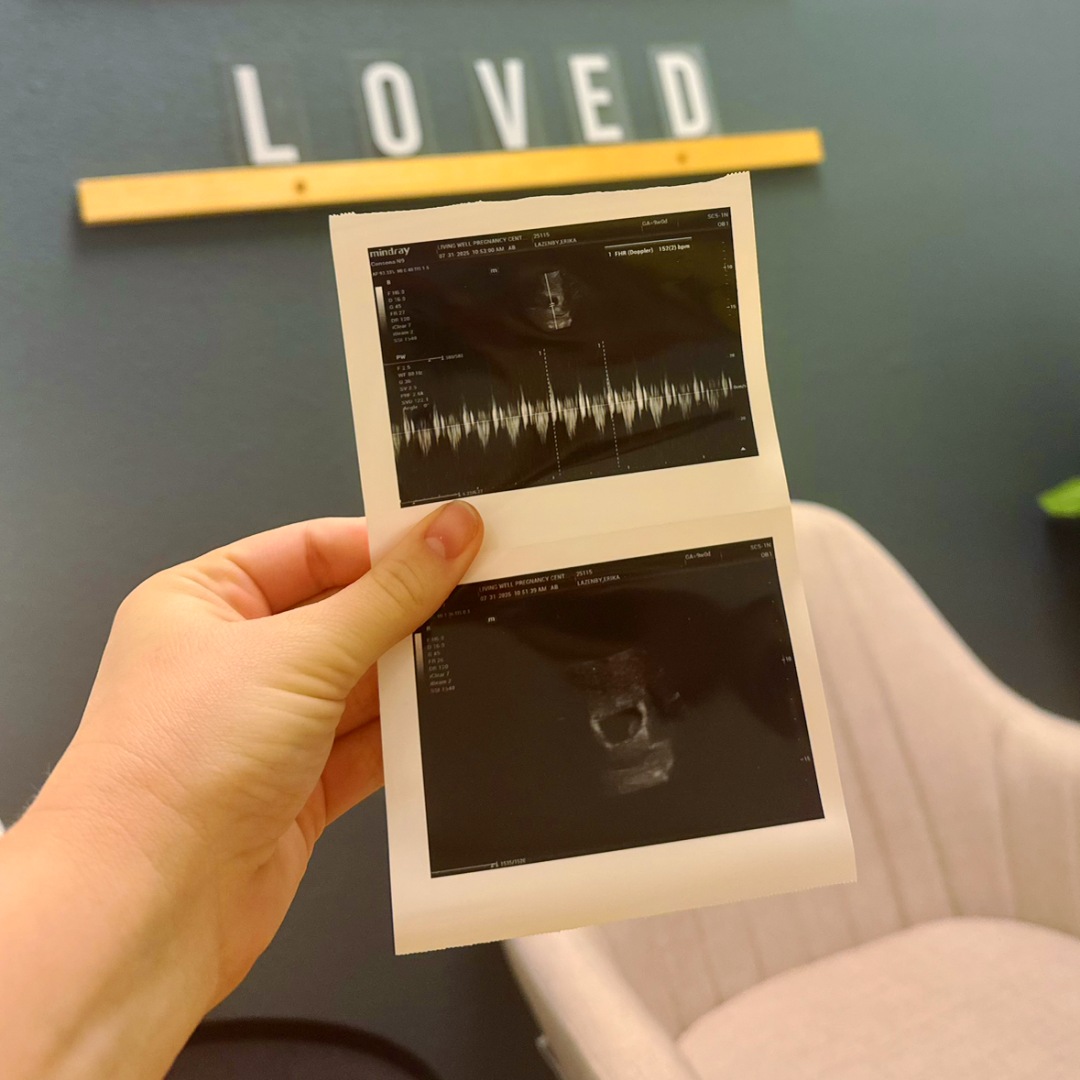 Photo shared by Erika for their Babylist baby registry.