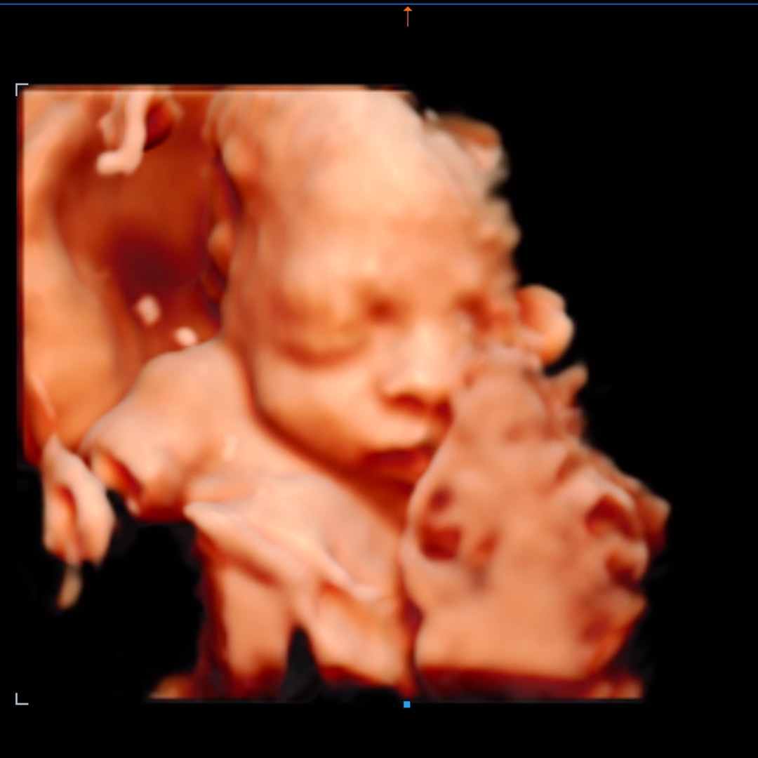 Photo shared by Vivean for their Babylist baby registry.