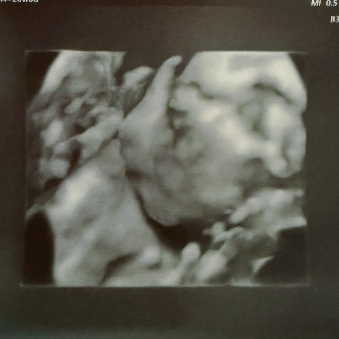 Photo shared by Caroline for their Babylist baby registry.