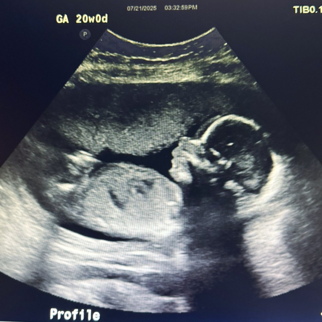 Photo shared by Courtney for their Babylist baby registry.