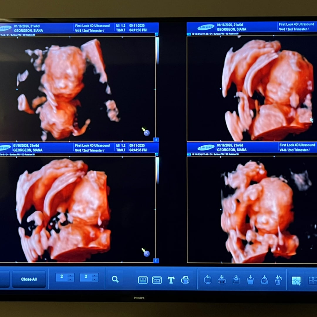 Photo shared by Siana for their Babylist baby registry.