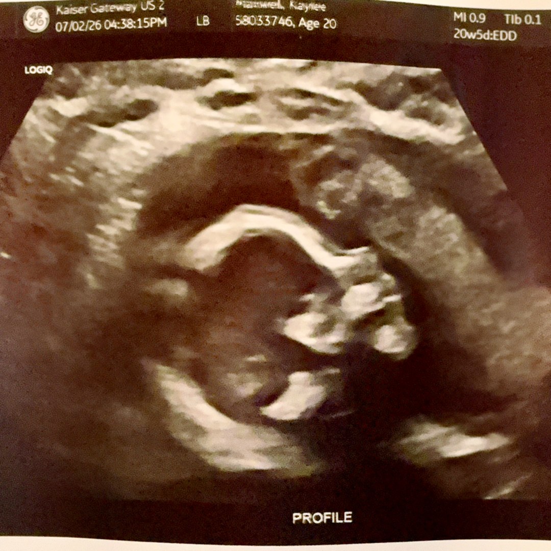 Photo shared by Kaylee for their Babylist baby registry.