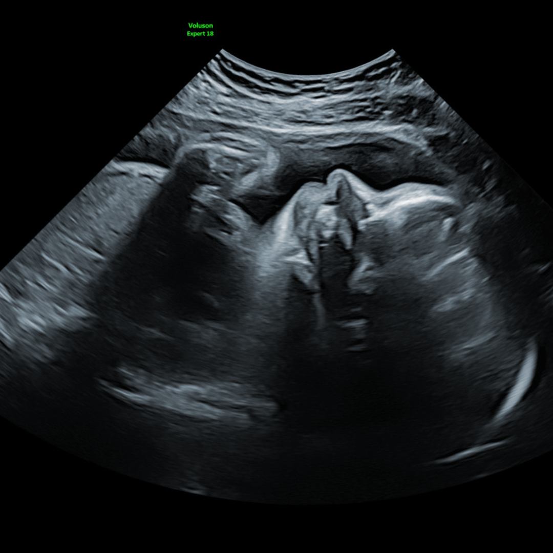 Photo shared by Aniya for their Babylist baby registry.