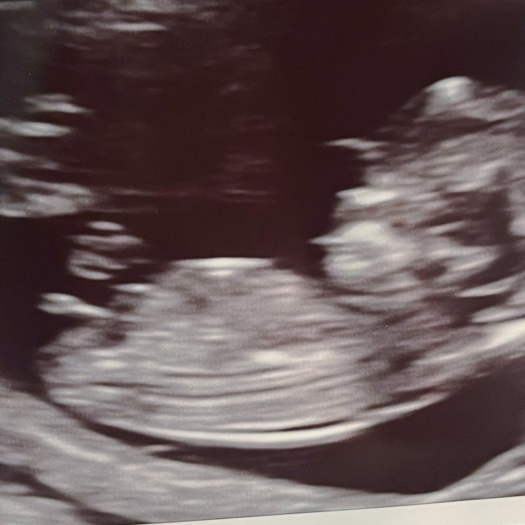 Photo shared by Haley for their Babylist baby registry.