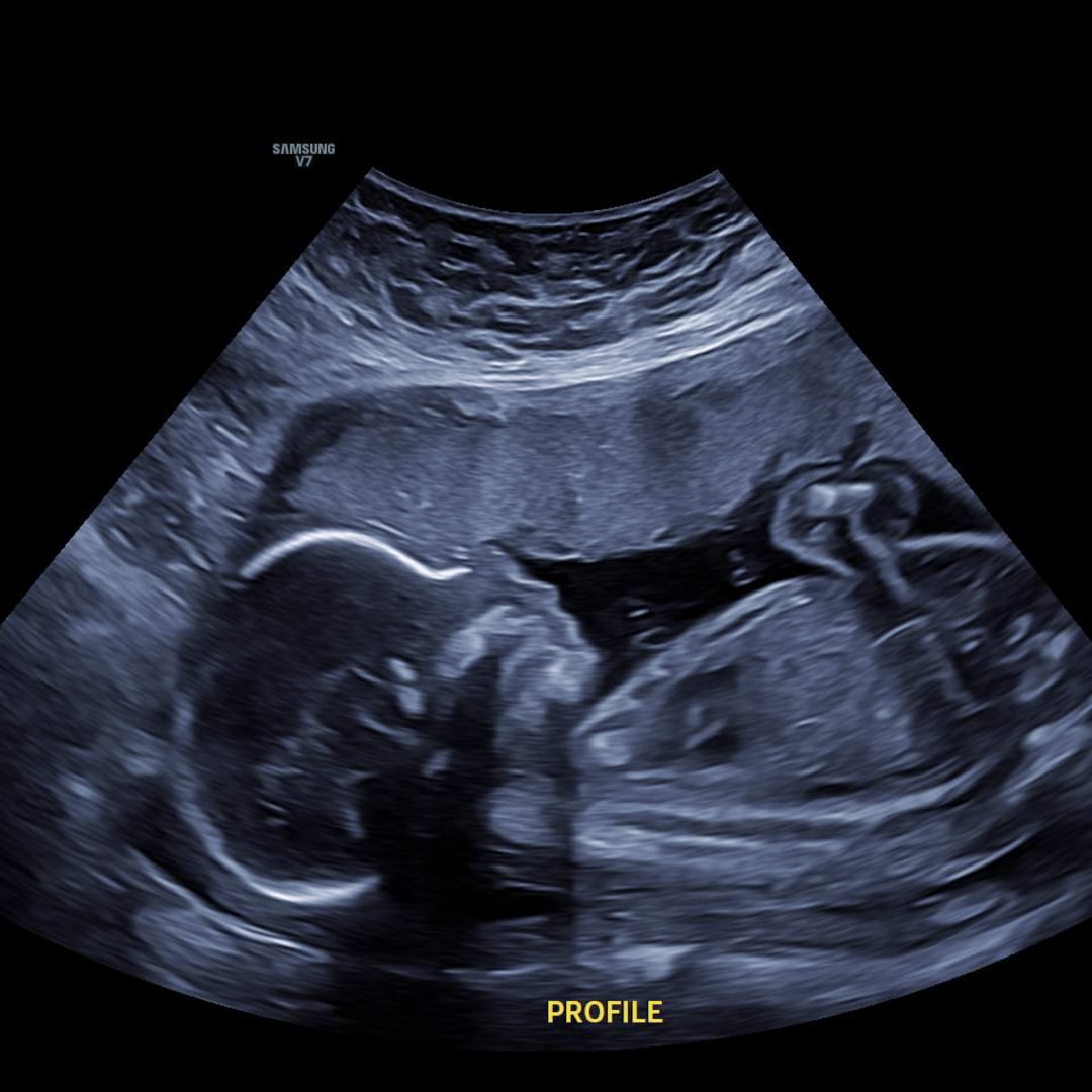 Photo shared by Chelsea for their Babylist baby registry.