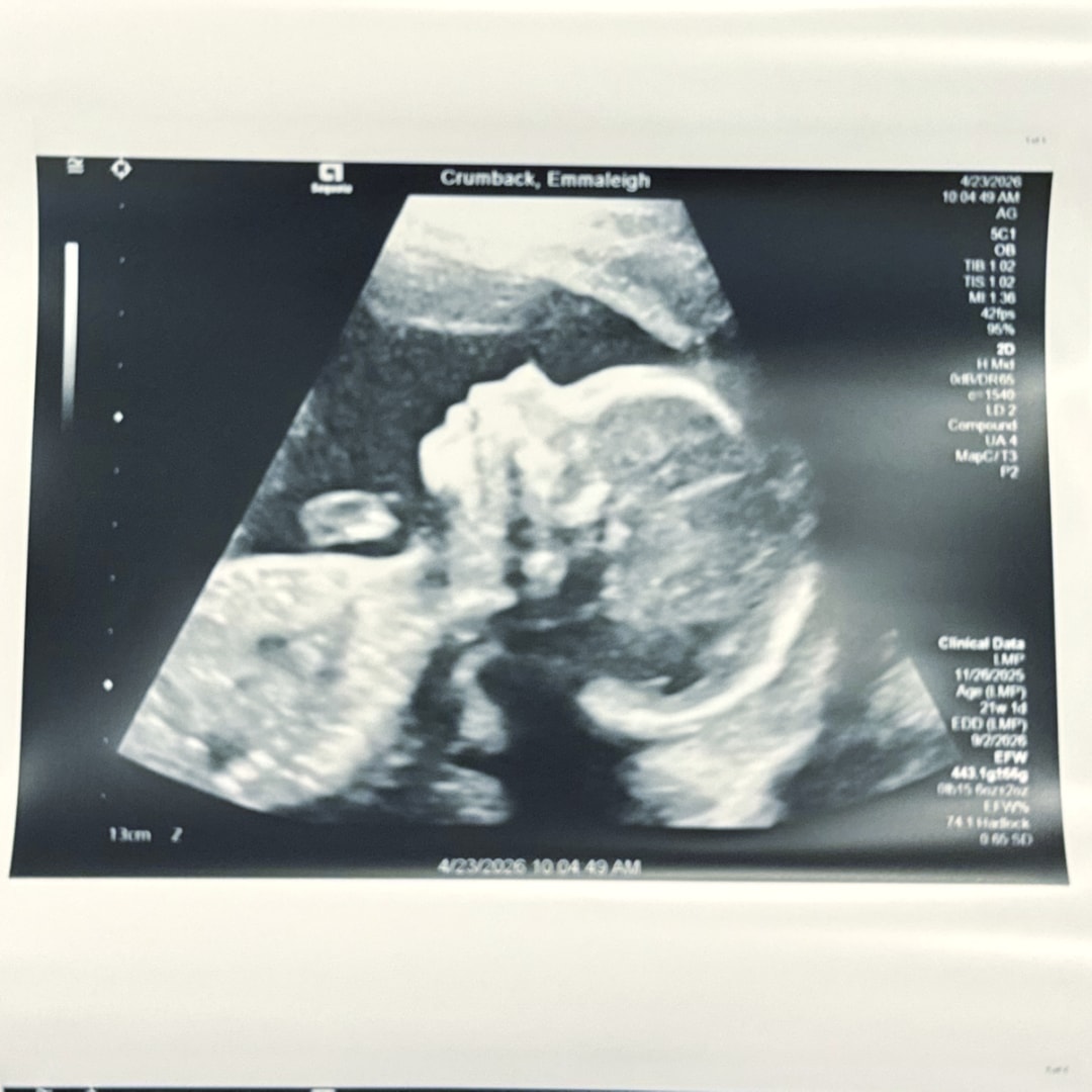 Photo shared by Emma for their Babylist baby registry.