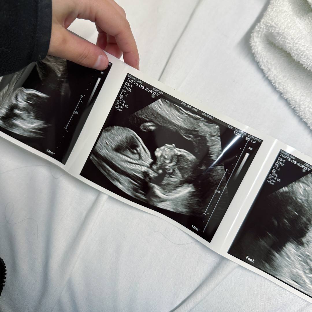 Photo shared by Julia for their Babylist baby registry.