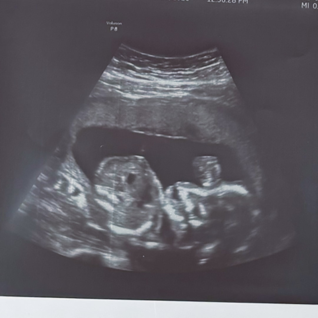 Photo shared by Naia for their Babylist baby registry.