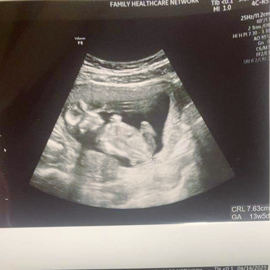 Photo shared by Alandra for their Babylist baby registry.