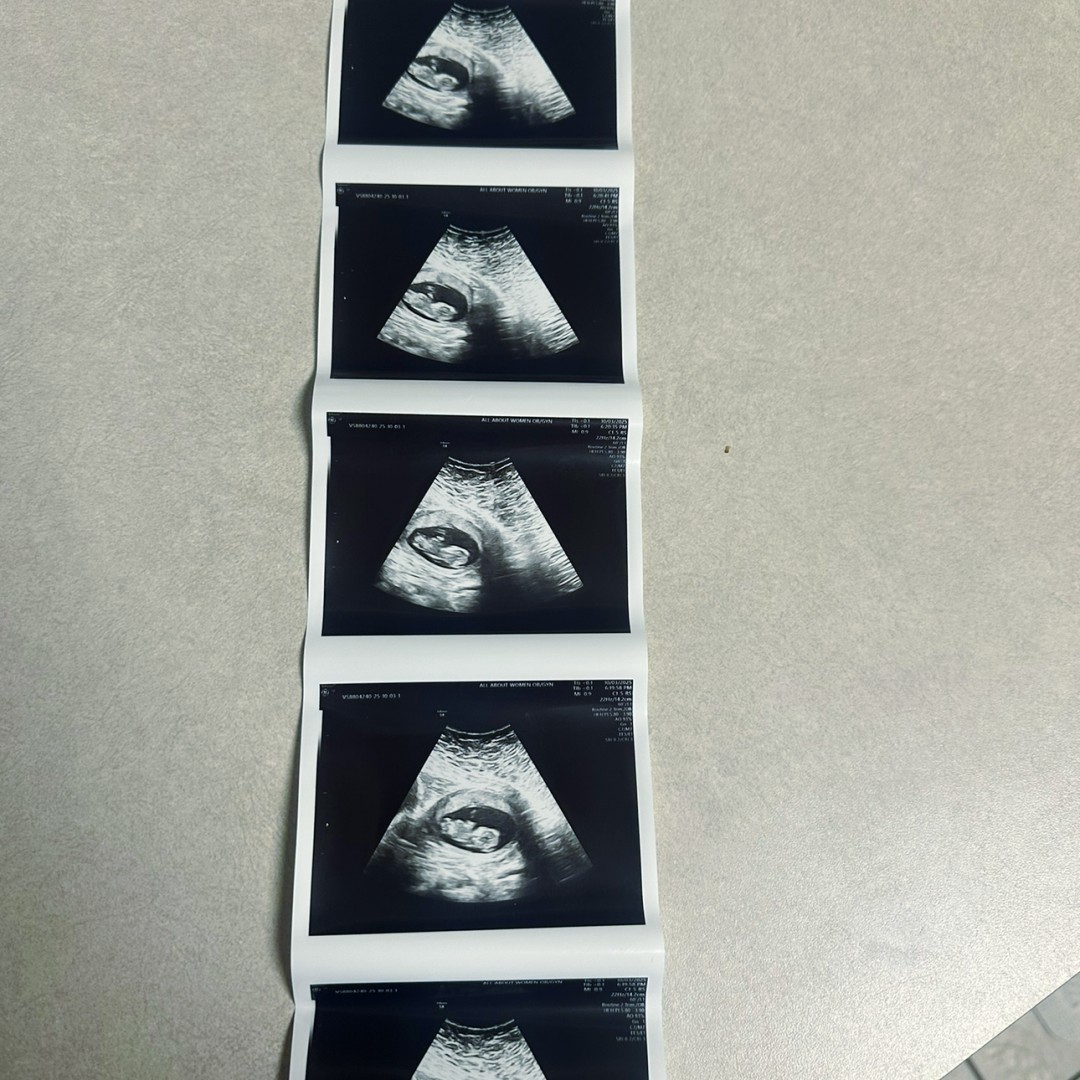 Photo shared by Emily for their Babylist baby registry.