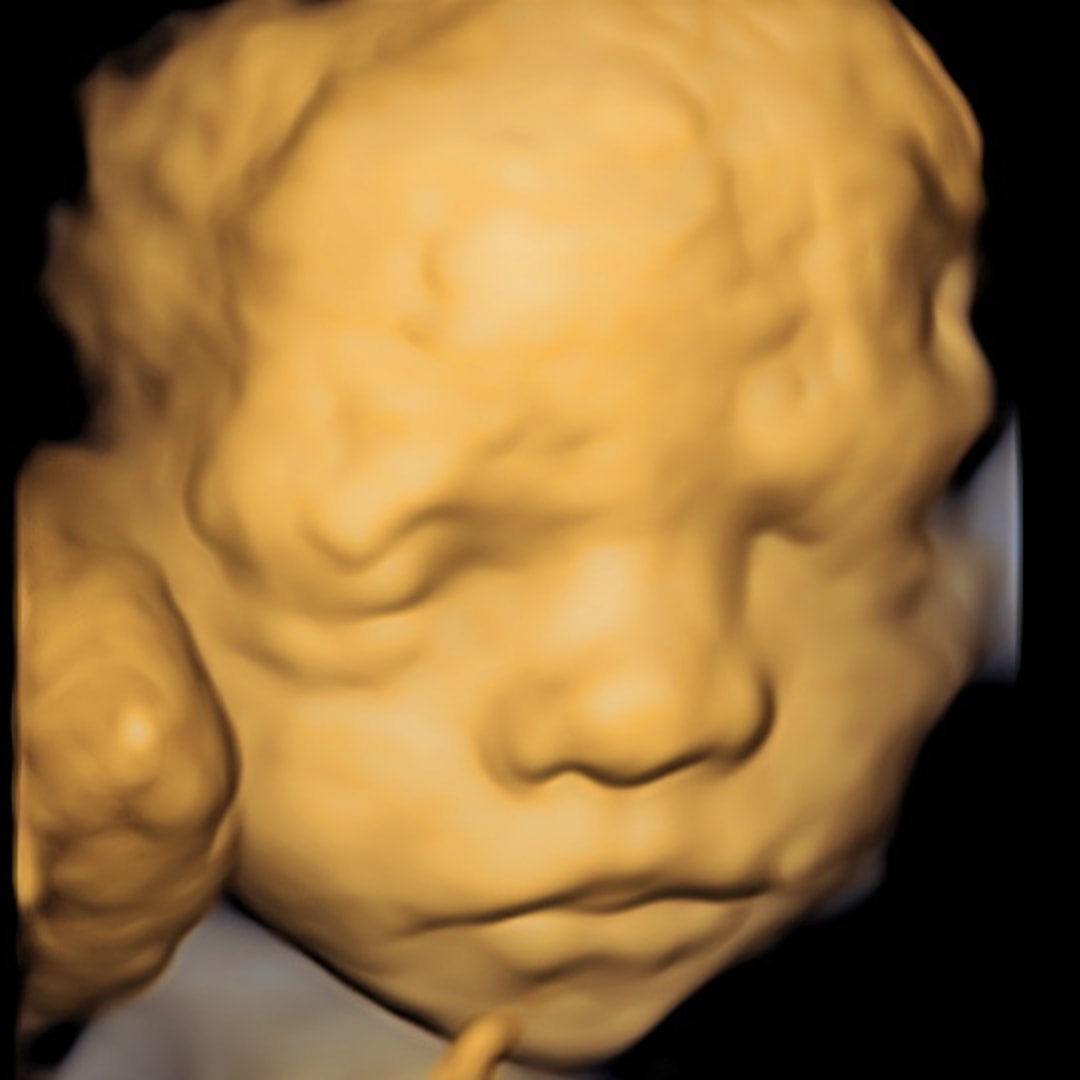 Photo shared by Lindsey for their Babylist baby registry.